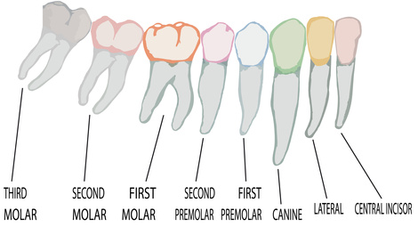 wisdomtooth